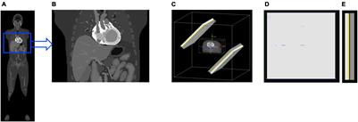 Monte Carlo Simulation and Reconstruction: Assessment of Myocardial Perfusion Imaging of Tracer Dynamics With Cardiac Motion Due to Deformation and Respiration Using Gamma Camera With Continuous Acquisition